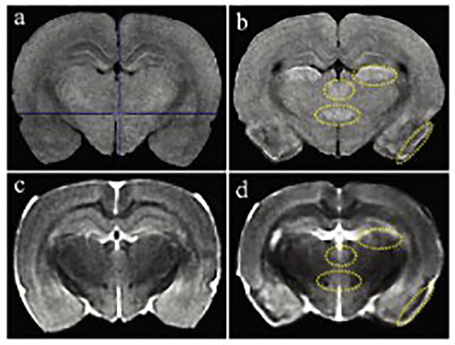 Application of Small Animal MRI System in the Evaluation of Brain Injury in Rats